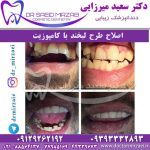 اصلاح طرح لبخند