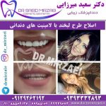 خنده هالیوودی