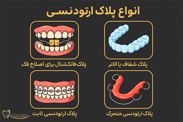 انواع پلاک ارتودنسی