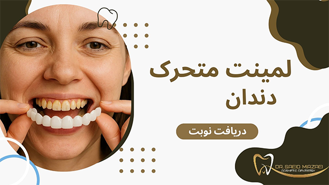لمینت متحرک چیست
