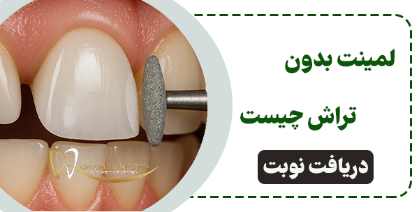 لمینت دندان بدون تراش
