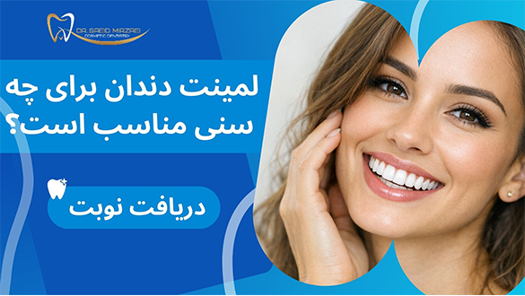 لمینت دندان برای چه سنی مناسب است؟