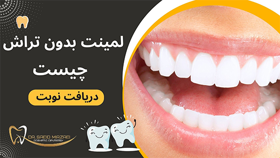 کاندید لمنیت بدون تراش