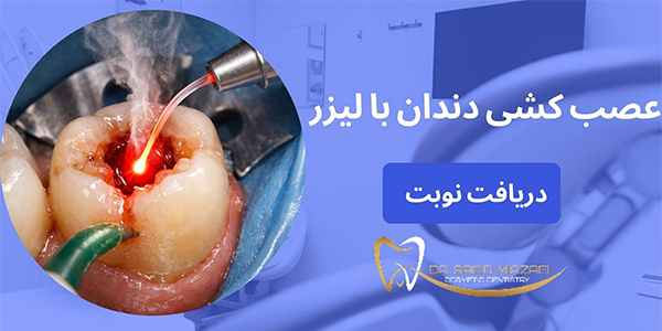 عصب کشی با لیزر چیست