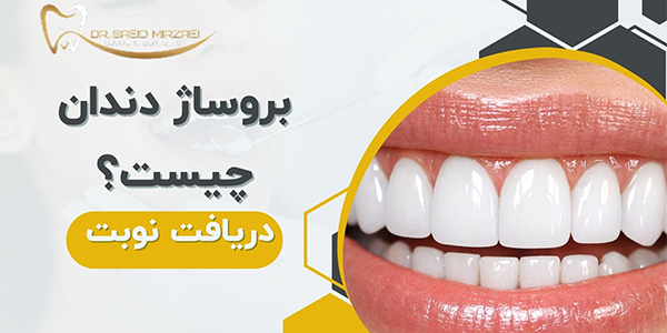 بروساژ دندان مراحل
