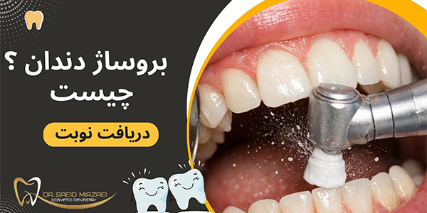 بروساژ دندان چیست؟