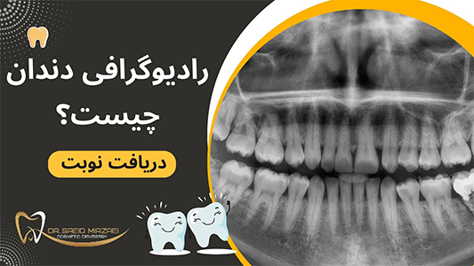 رادیوگرافی دندان چه کاربردی دارد؟