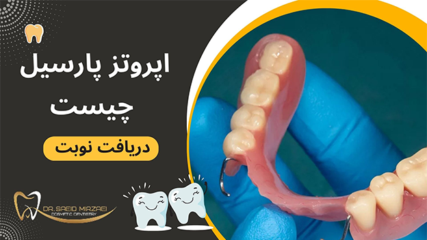 عمر مفید پروتز پارسیل چقدر است؟