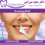 ماندگاری لمینیت ها