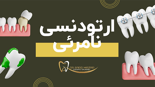 چه کسانی نیاز به ارتودنسی نامرئی