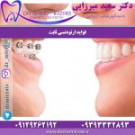 فواید ارتودنسی ثابت