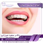 انواع ارتودنسی دندان