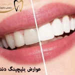 عوارض بلیچینگ دندان