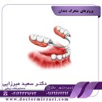 پروتزهای متحرک دندان