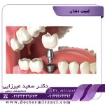 مراقبت از ایمپلنت دندان