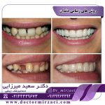 روش های زیبایی دندان
