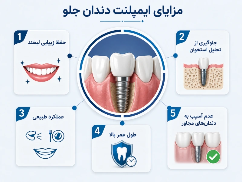 ایمپلنت دندان های جلو