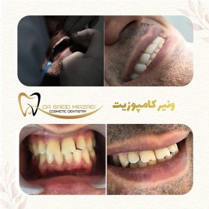 نمونه کار زیبایی دندان 18