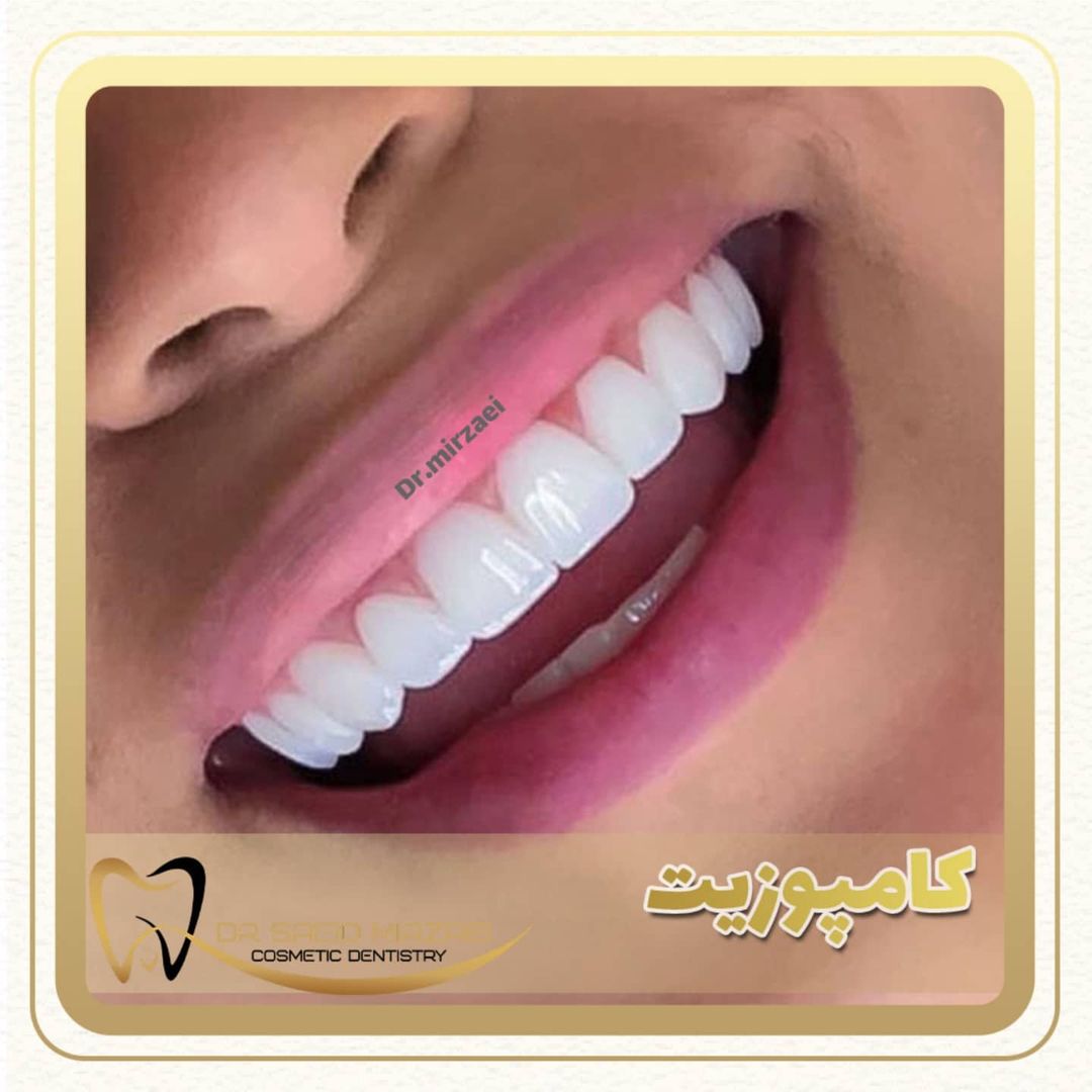 نمونه کار زیبایی دندان 6