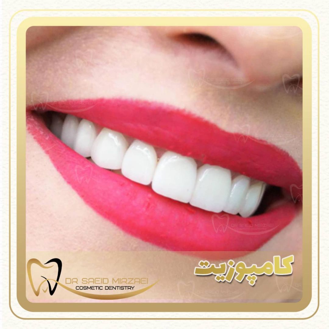 نمونه کار زیبایی دندان 3