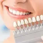 انتخاب رنگ لمینت دندان دکتر میرزایی