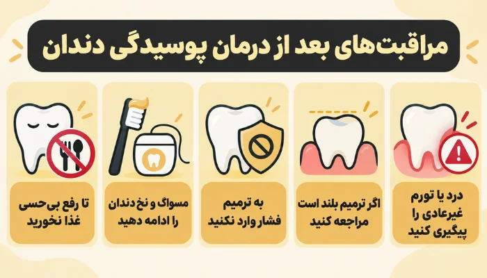 مراقبتهای بعد از درمان پوسیدگی دندان شامل رعایت بهداشت دهان، محافظت از ترمیم و پیگیری درد یا تورم غیرعادی