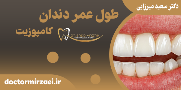 طول عمر کامپوزیت ونیر