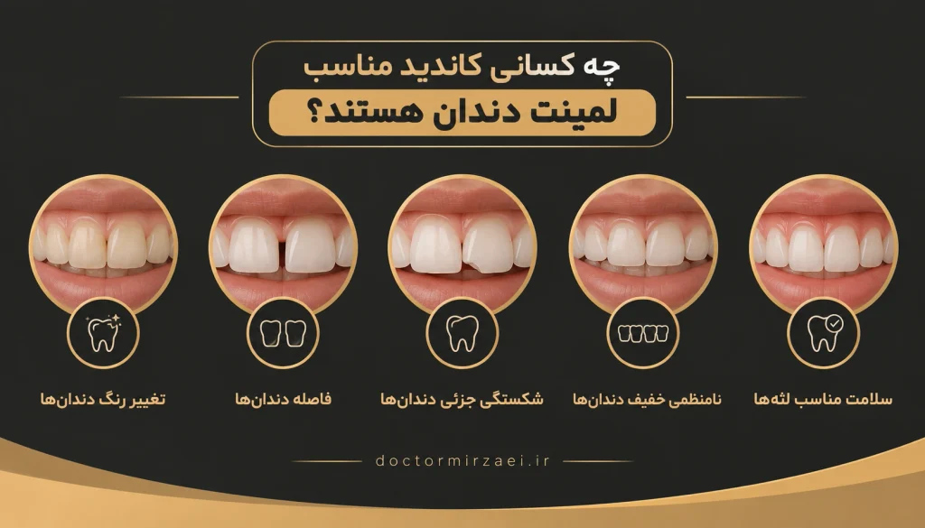 چه کسانی کاندید مناسب لمینت دندان هستند