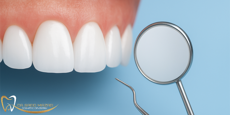 لمینت دندان