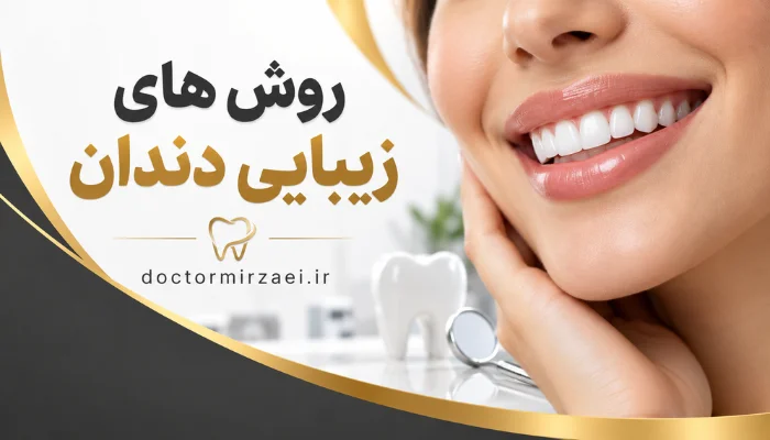 روش های زیبایی دندان و اصلاح طرح لبخند