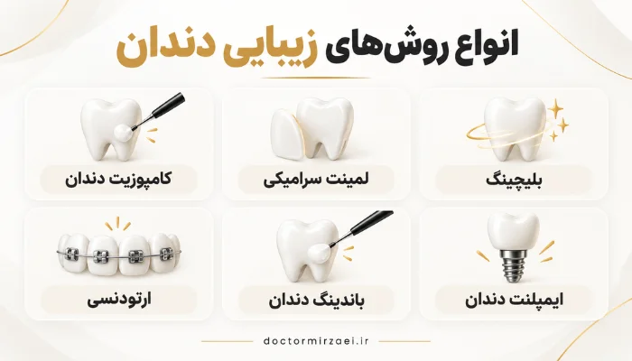 انواع روش های زیبایی دندان شامل کامپوزیت، لمینت، بلیچینگ، ارتودنسی، باندینگ و ایمپلنت