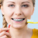 مراقبت های حین بعد از ارتودنسی