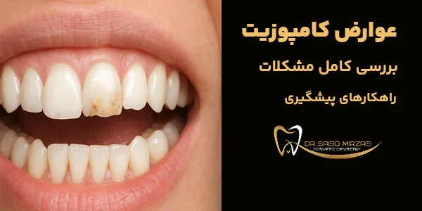 عوارض کامپوزیت دندان چیست