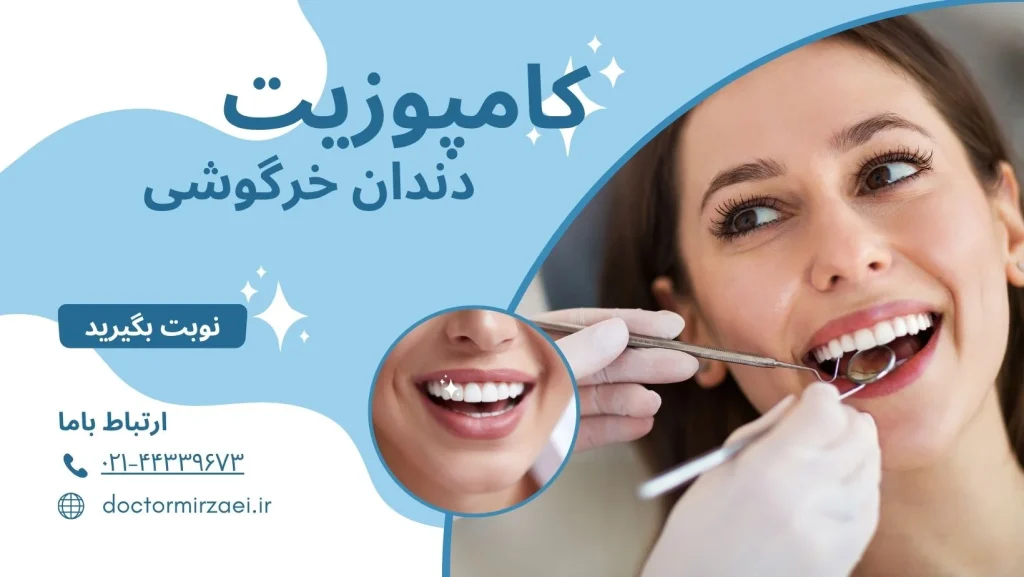 کامپوزیت دندان خرگوشی چیست