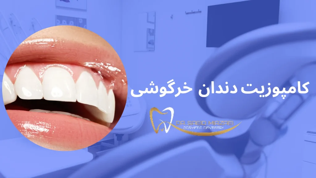 مزایای دندان خرگوشی