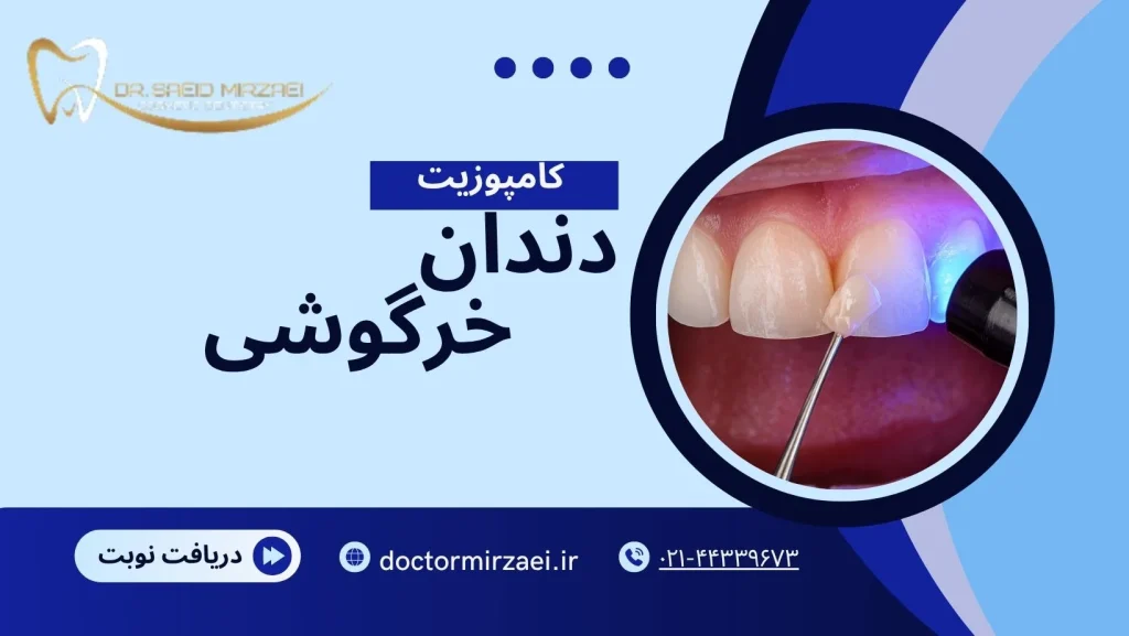 کاپوزیت دندان خرگوشی