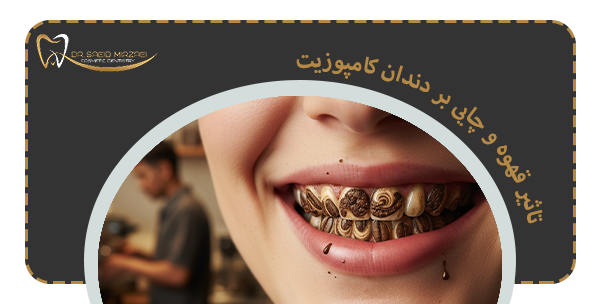تاثیر قهوه و چایی بر دندان کامپوزیت چیست